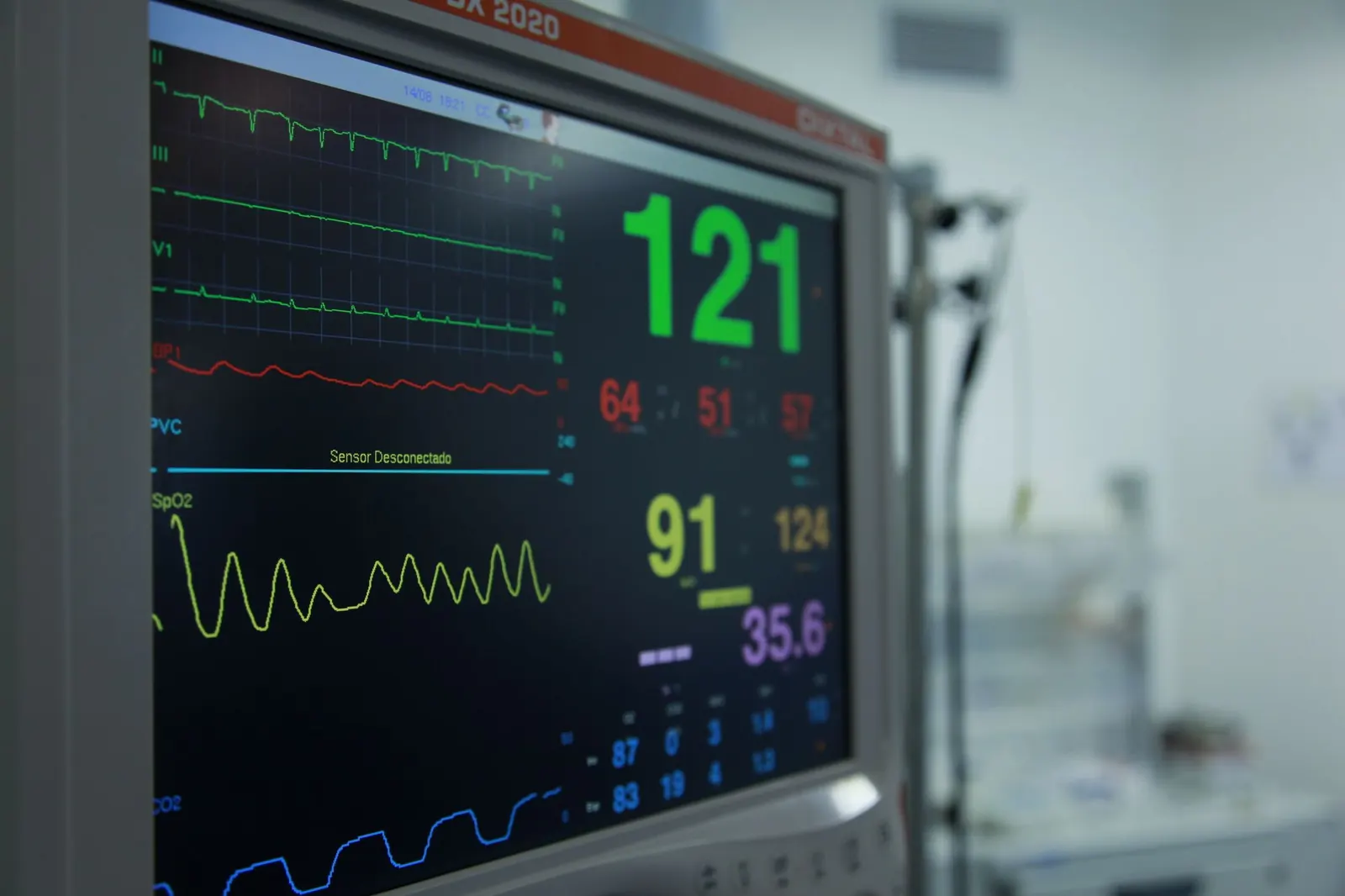 Illustration of a bedside patient monitor showing vital signs